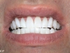 new enlighten whitening work completed