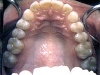 white_filling_sml5a